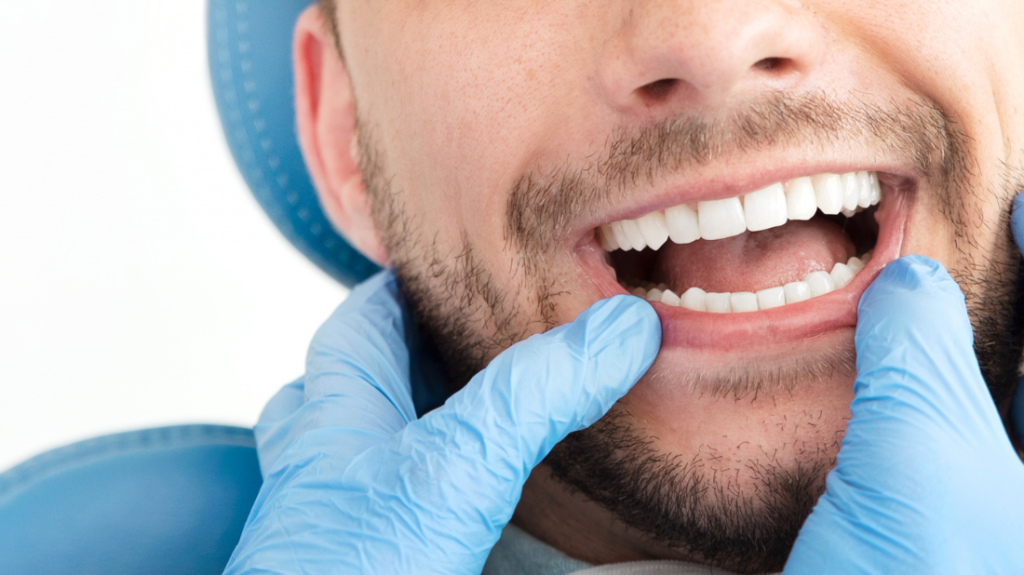 Zoom sur les dents d'un jeune homme qui se fait examiner par un dentiste et nécessitant de soins au reste à charge 0