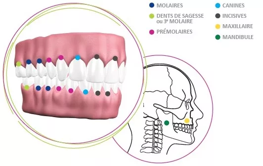 schéma illustratif dentaire placant les molaires, dents de sagesse, prémolaires, canines, incisives, maxillaire et mandibule.