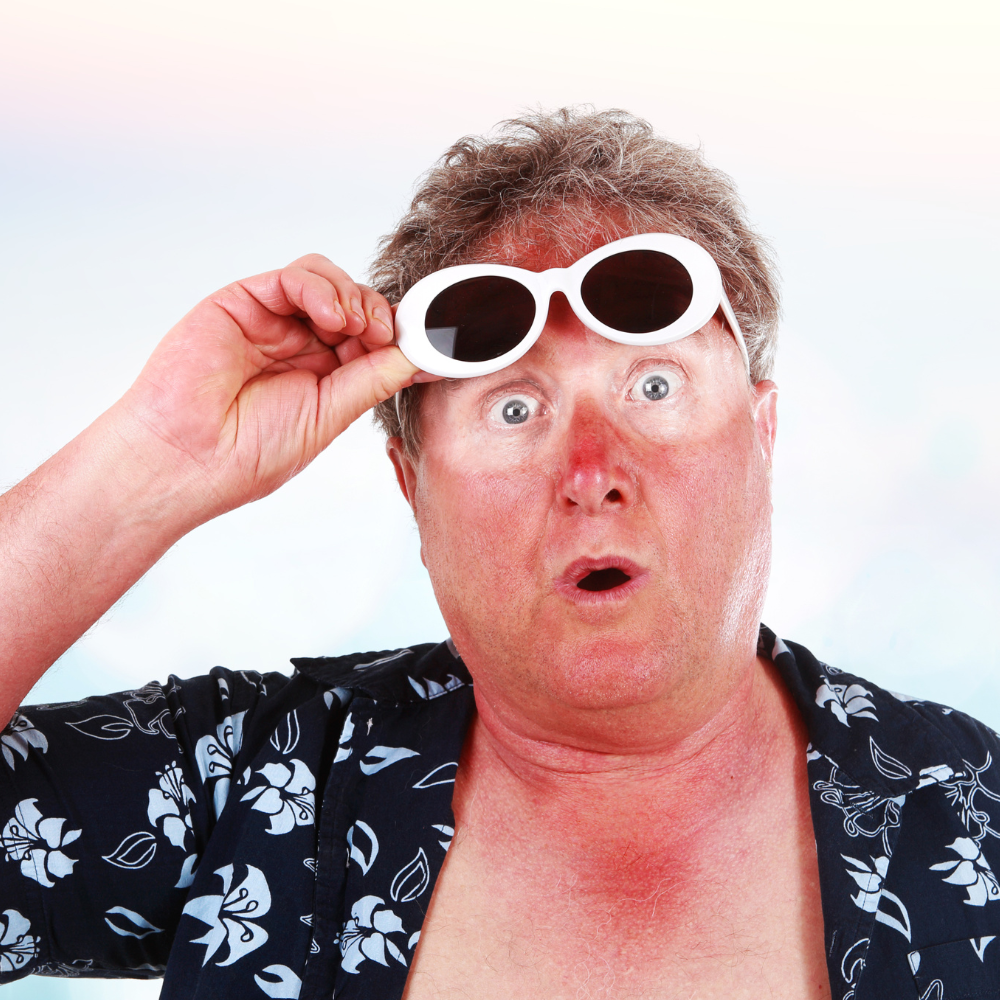 homme avec des lunettes de soleil ayant eu des coups de soleil au visage durant son été